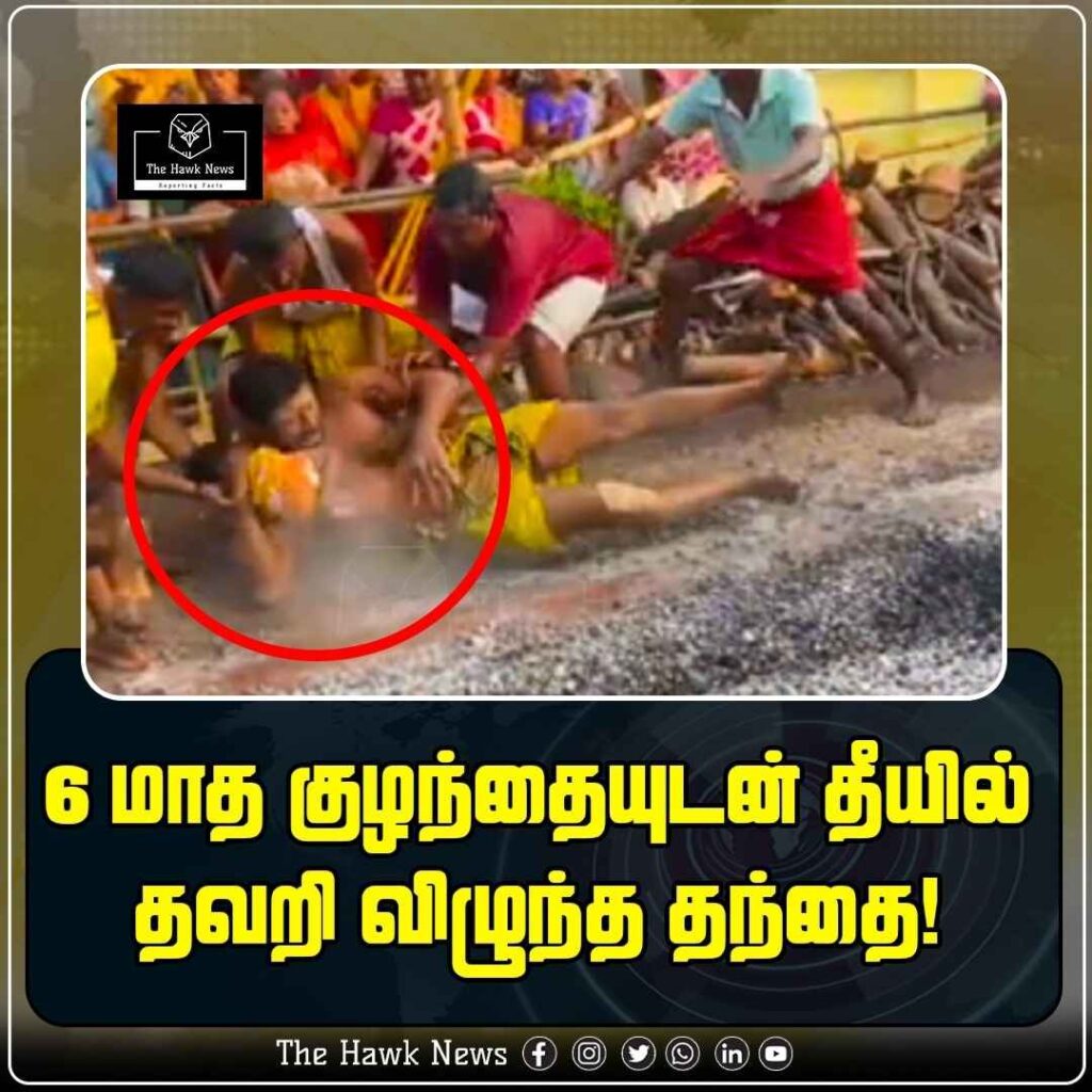 6 மாத குழந்தையுடன் தீயில் தவறி விழுந்த தந்தை