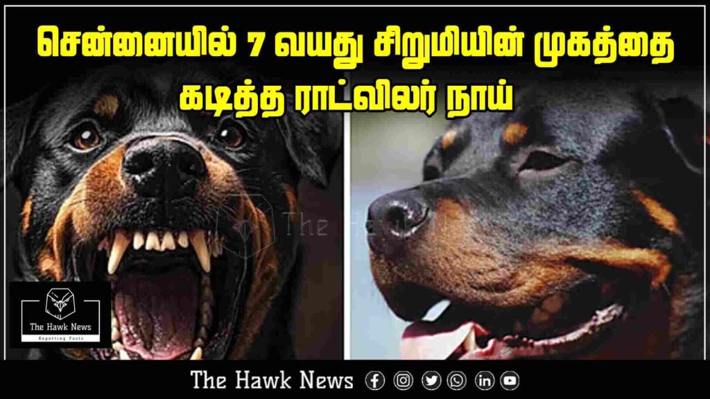 "7-year-old girl severely injured after Rottweiler bites her face in Chennai."